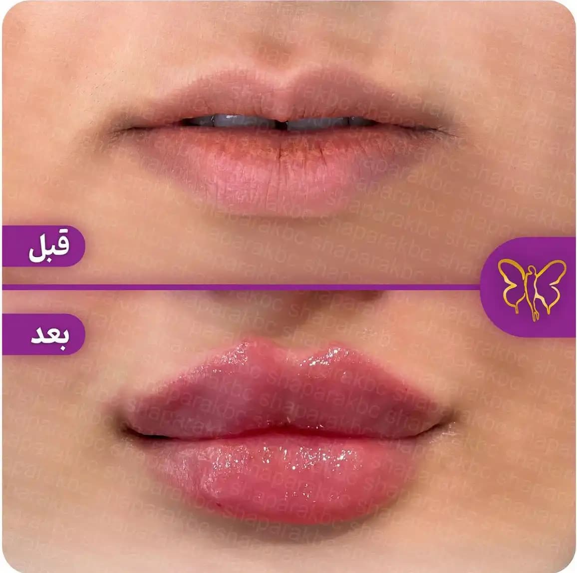 کلینیک تخصصی پوست و مو شاپرک